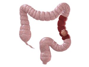 El Colon